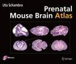 Prenatal mouse brain atlas: color images and annotated diagrams of: Gestional days 12, 14, 16 and 18, sagittal, coronal and horizontal section 
