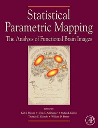 Statistical parametric mapping: the analysis of functional brain images